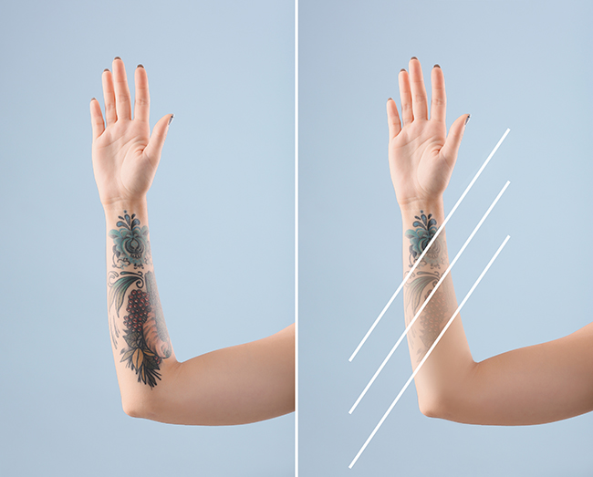Young woman before and after laser tattoo removal procedure on color background, closeup